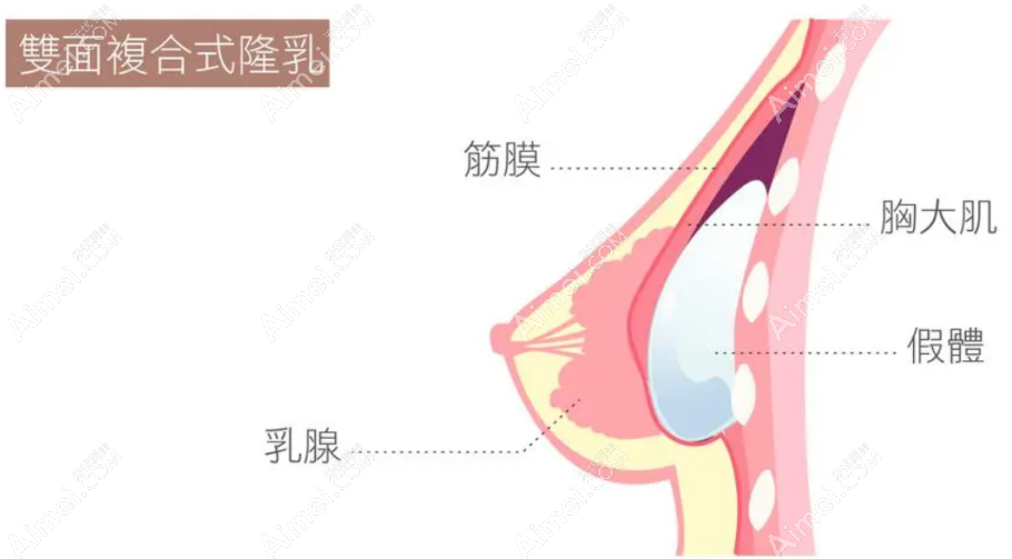 穆大力隆胸国内排名前十，属于国内隆胸技术比较高的医生之一