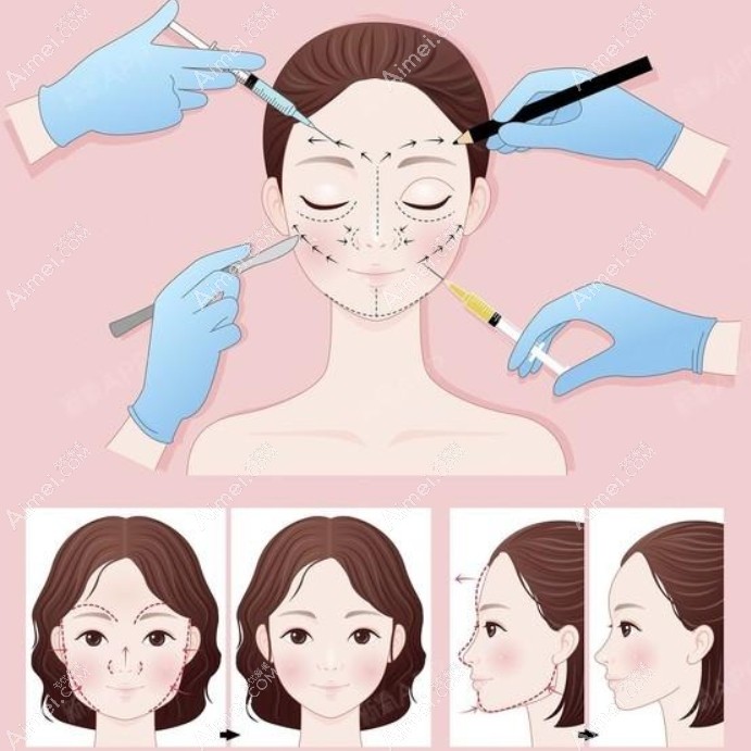 青岛打轮廓针好的医院还不少