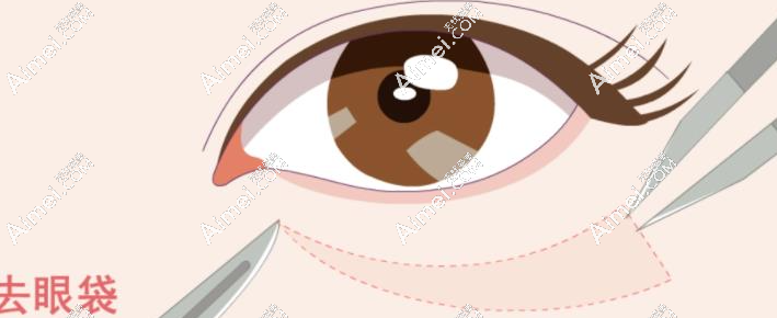 m.aimei.com2024大連做外切去眼袋醫(yī)生排名:劉志剛/王香平上榜前列,人氣口碑等有的一拼