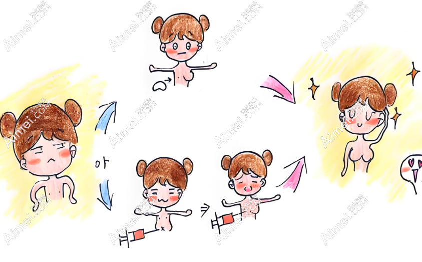 冯斌自体脂肪隆胸存活率高