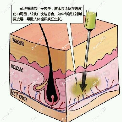 周云超做生长因子取出的技术优势