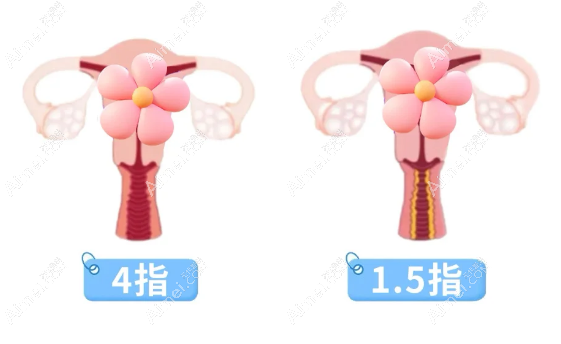 广州紧缩针多少钱一支