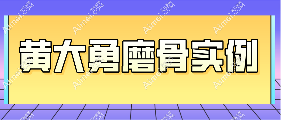 黄大勇磨骨实例分享