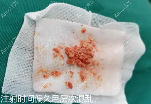 在荔湾区医院清奥成功有多少 在荔湾区医院清奥成功有多少