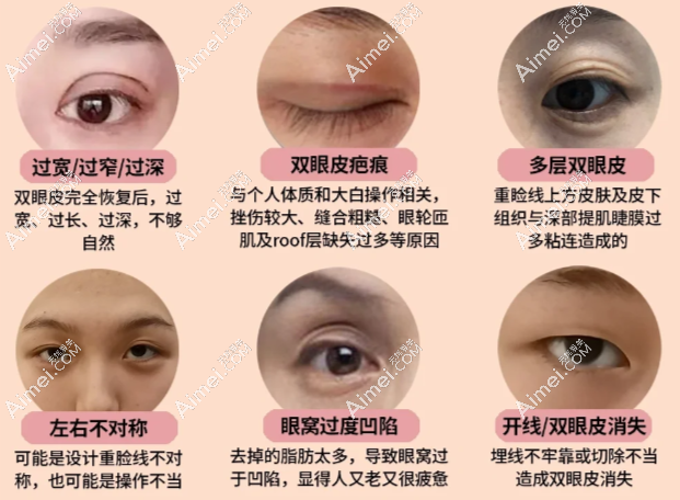 郑小红修复有失败实例么