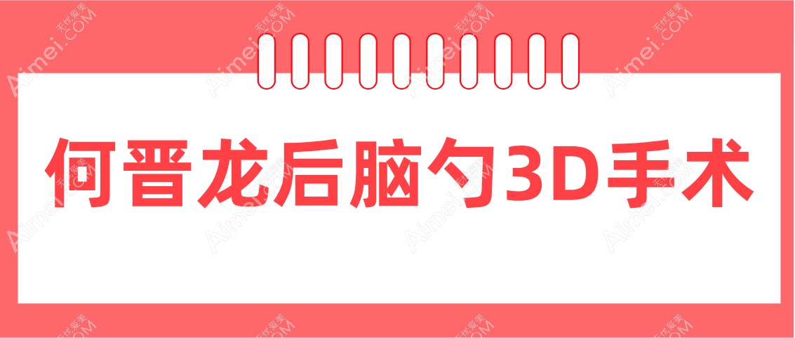 何晋龙后脑勺3D手术
