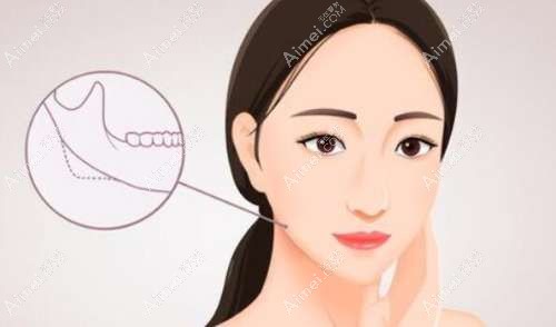 李继华磨骨手术前后对比明显