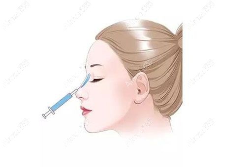 北京可以打濡白天使医生名单公布 北京可以打濡白天使医生名单公布