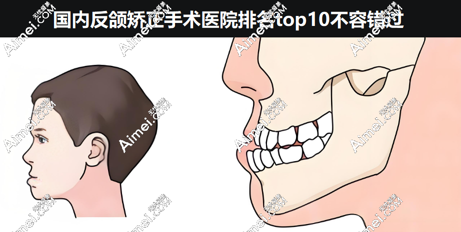 2025国内反颌矫正手术医院排名-大众推荐热度评分前10强,正规靠谱技术好