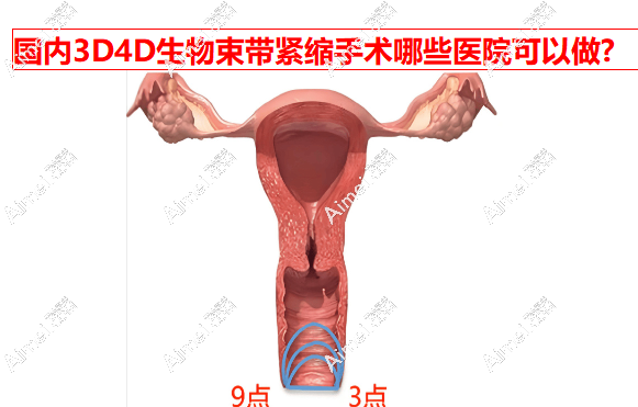 国内3d4d生物束带紧缩手术有哪些医院可以做?top10名单发布,均价14380元