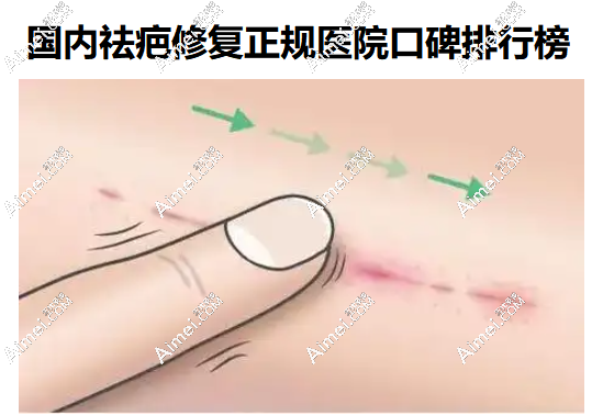 国内祛疤痕修复医院排行榜前20名排名公示-疤痕专科医院公认的实力佳技术稳定