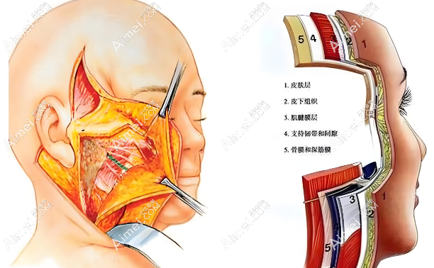 倪峰拉皮属于什么档次?经查证属于高端档次(倪峰拉皮中下面部收费均价45000元~68000)