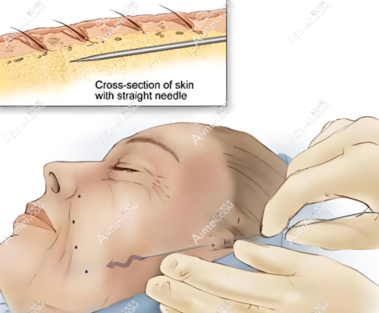 倪峰拉皮属于高端档次 倪峰拉皮属于高端档次