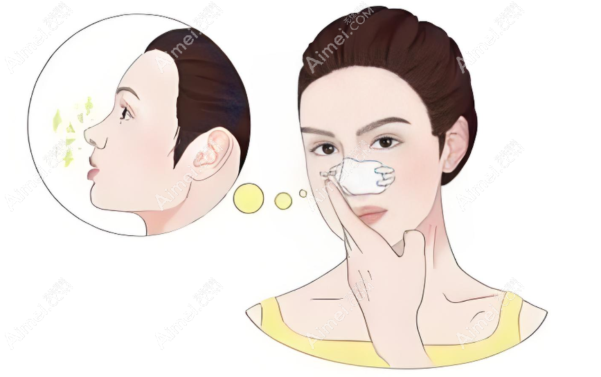 福州鼻修复做得好的医生排名前八
