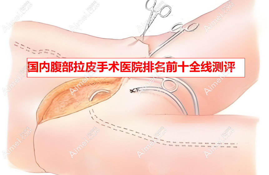 2025國內(nèi)腹部拉皮手術(shù)醫(yī)院排名前十全線測評_北京華韓/西安國醫(yī)可以放心選