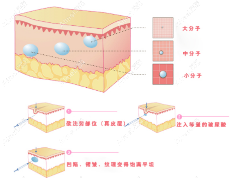 上海薇琳醫(yī)療美容醫(yī)院注射
