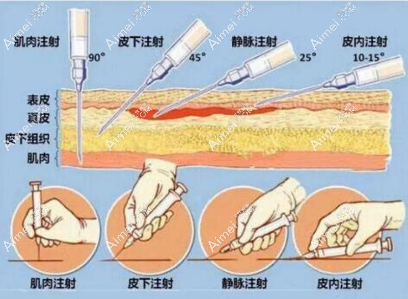aimei.com上海薇琳醫(yī)療美容醫(yī)院注射