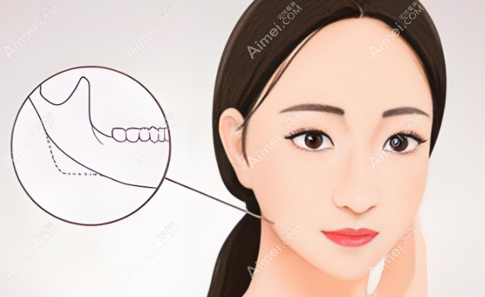 朱乐林轮廓手术做的怎么样呢?是好在重庆松山可以预到他 朱乐林轮廓手术做的怎么样呢?是好在重庆松山可以预到他