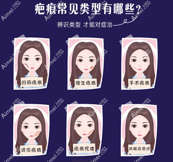北京特色疤痕修复医院哪家好