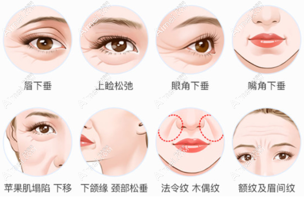 北京拉皮特色整形医院哪家好