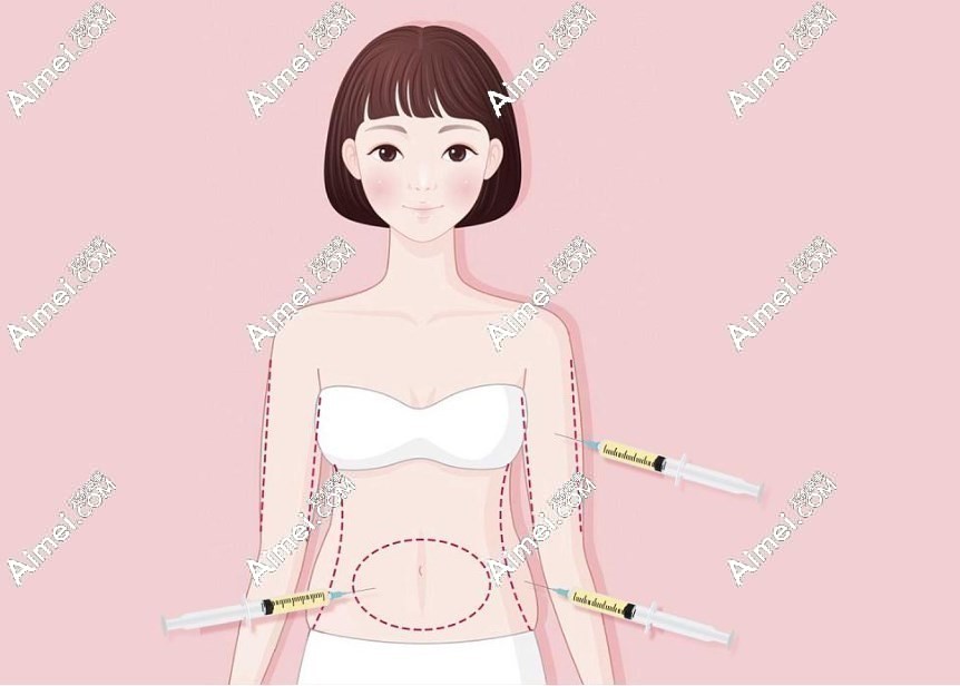 王自谦吸脂价格