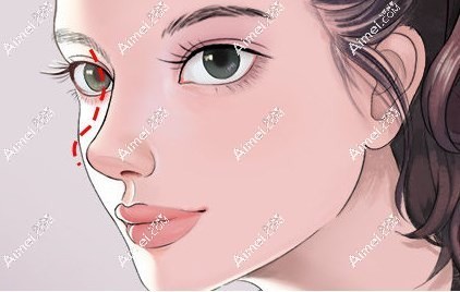 成都周柯做修复鼻怎么样?口碑不错,顾客满意度高,可预约哦