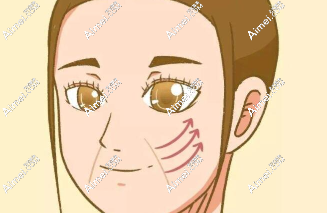 2025法令纹医美去除方法:拉皮/热玛吉/玻尿酸/埋线提升都有成效,怎么选看这!