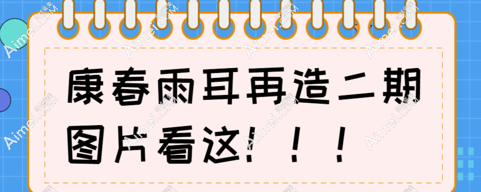 康春雨耳再造二期图片查看:一起看看康春雨做过的耳再造患者分享