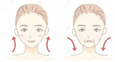 据考察:刘远程医生排名前十,面部抗衰费用一般五万,没失败实例口碑不差,是比较推荐的