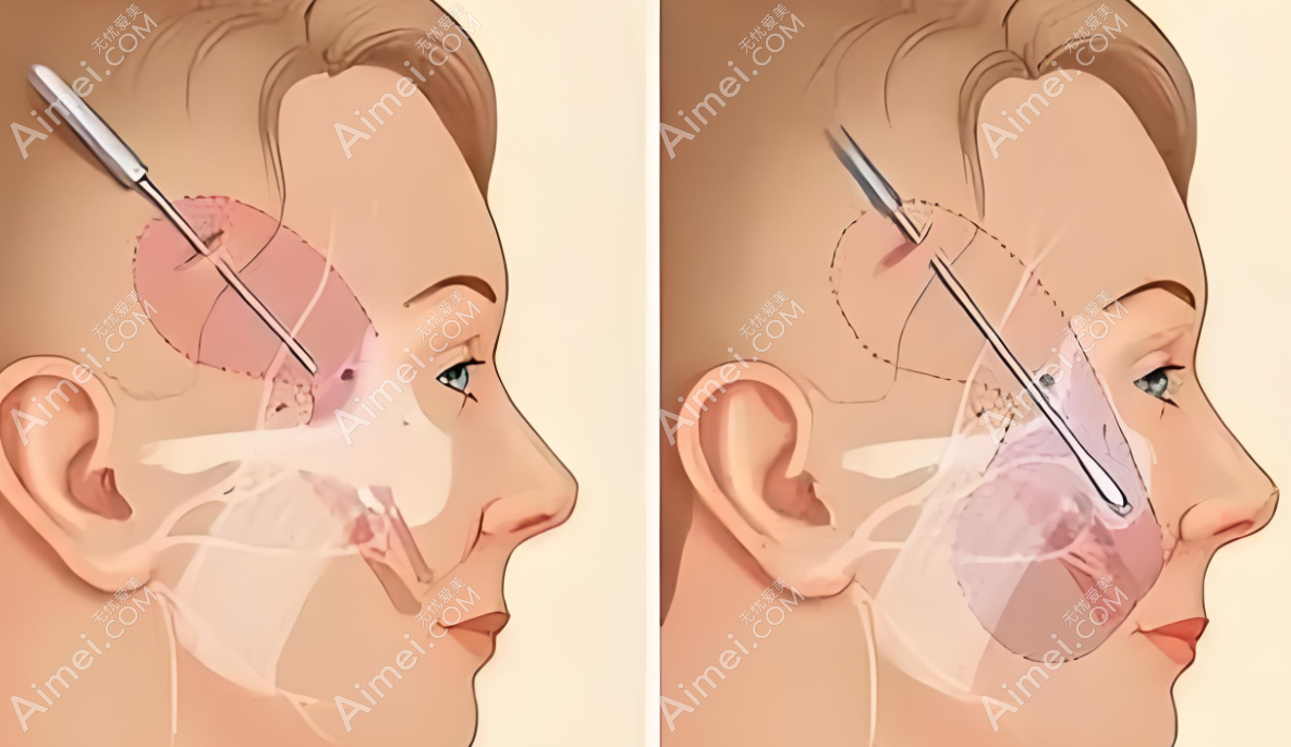 成都刘远程医生口碑评价怎么样？