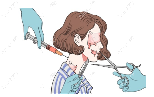 柳民熙拉皮手术做得好，因为柳民熙深平面提升技术抗衰功效好