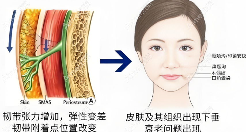 成都李建刚医美失败修复成功实例多,无痕筋膜提升显著不是骗局,整容前后对比明显