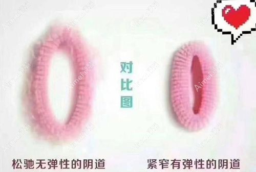 紧缩针哪里可以打