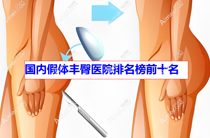 国内假体丰臀医院排名榜前十名(深圳福雅,南雅,武汉仁爱位列前三)塑形逼真手感柔软