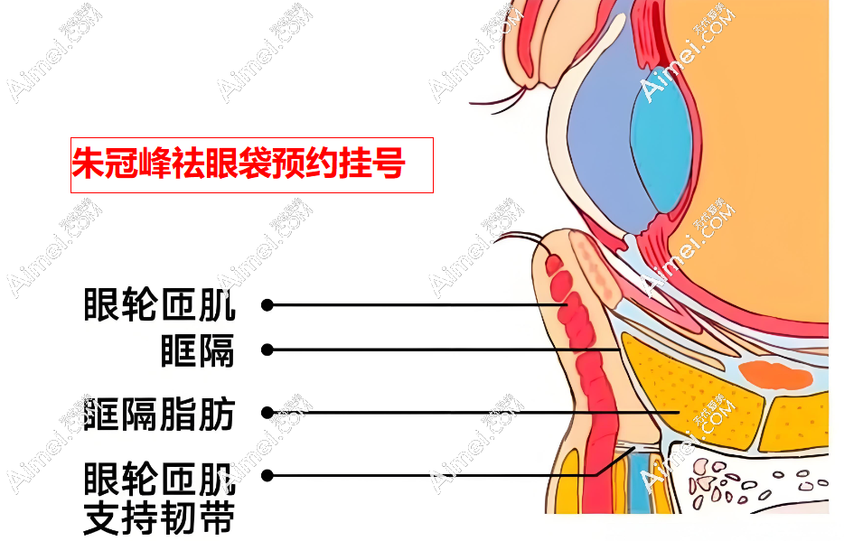 【深圳朱冠峰祛眼袋预约挂号】医生简介/医院地址/小助理联系方式在线获取