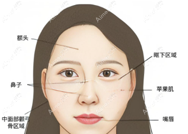 钟杰光治疗费用坑吗？