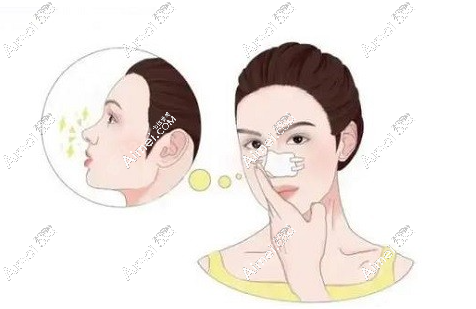 成都齊丙迪做鼻子好嗎?從齊丙迪真人鼻綜合實例來看他做鼻子真的好看    m.aimei.com