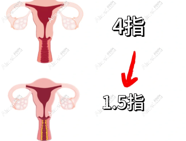 温州有紧缩针的医院:粉范|艺星等七家医院有私密紧缩针,收费透明速来预约！   m.aimei.com