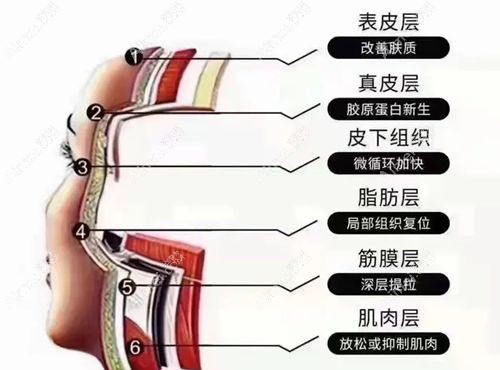 全脸做美拉美超声刀10000元起一次，比热玛吉做全脸29800元便宜但提升成效不打折