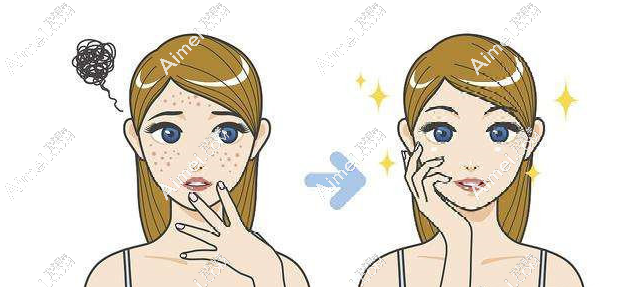 美国赛诺秀蜂巢皮秒和超皮秒的区别:蜂巢皮秒针对黑色素|超皮秒针对红黄褐斑 美国赛诺秀蜂巢皮秒和超皮秒的区别:蜂巢皮秒针对黑色素|超皮秒针对红黄褐斑