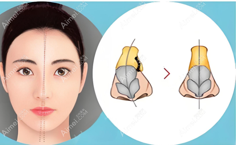 范荣杰医生预约挂号www.aimei.com
