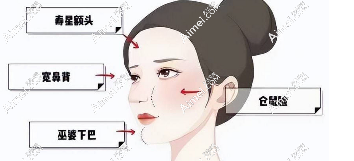 钟杰光馒化修复属于中高端档次,治疗费用不坑,体验了才知道性价比真的高