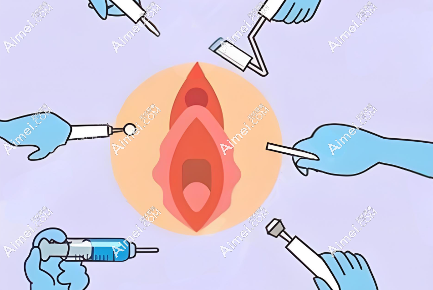 私密紧缩针可以维持6个月到1年左右,但一定要到正规医院打,不然维持成效... 私密紧缩针可以维持6个月到1年左右,但一定要到正规医院打,不然维持成效...