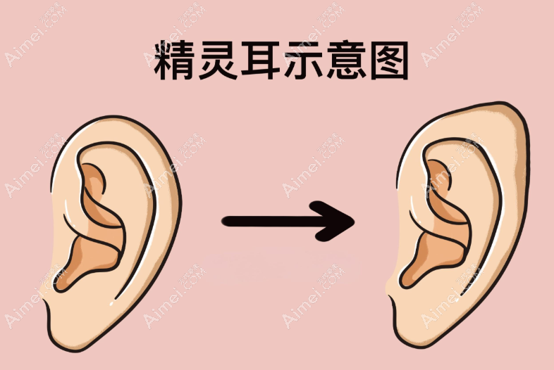 八大处李川简历一览(网红都找他做精灵耳,好看且收费不贵)微信挂号预约本人超快