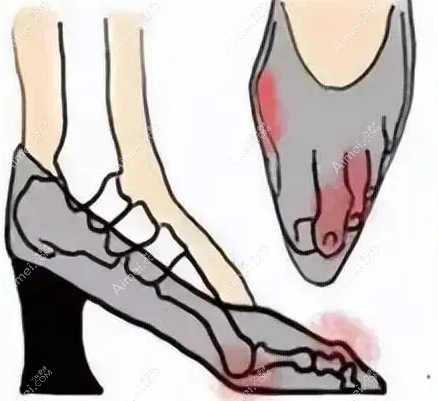 【 蘇敬達個人簡歷介紹】擅長微創(chuàng)大腳骨/拇指外翻矯正/腳踝外翻矯正-在3家醫(yī)院有資質(zhì)