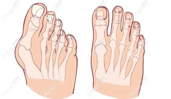 【 蘇敬達個人簡歷介紹】擅長微創(chuàng)大腳骨/拇指外翻矯正/腳踝外翻矯正-在3家醫(yī)院有資質(zhì)