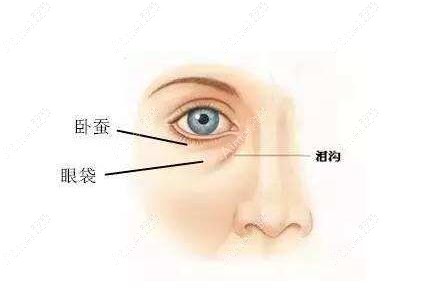 成都去眼袋的正规医院排行榜：健丽医美、纯曦、艺星等是祛眼袋技术好还便宜
