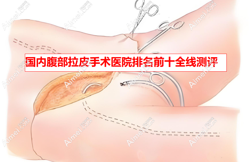 国内腹部拉皮手术医院排名前十 国内腹部拉皮手术医院排名前十