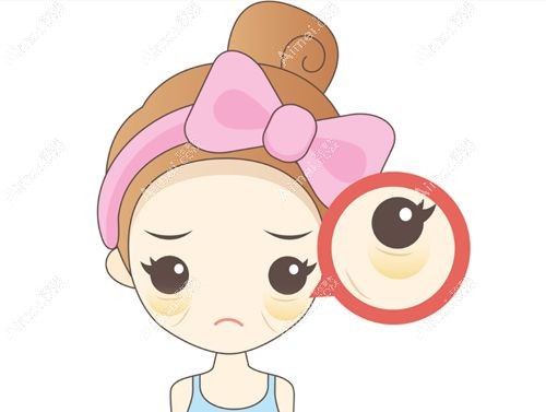 郑州东方贺洁怎么样，贺洁医生修复眼袋外翻/卧蚕/下眼睑腻害无失败例子