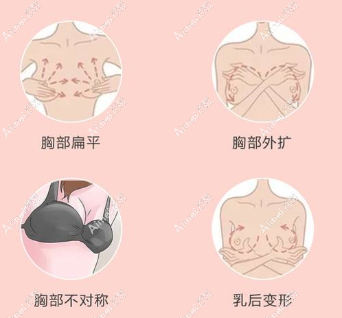 北京隆胸医院可以改善胸型aimei.com
